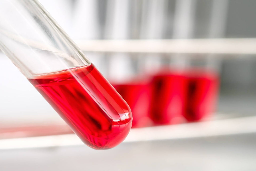 How to Do the Berkey Water Filter Red Dye Food Coloring Test